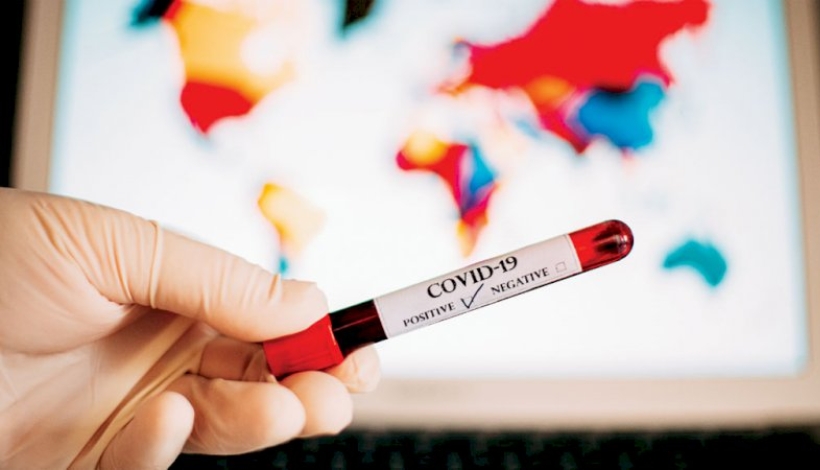 MT tem 28.791 mil casos de Covid-19 