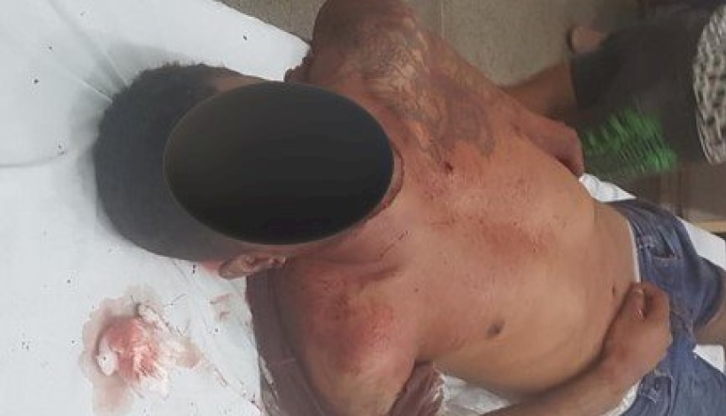 Homem é baleado e morto em Peixoto de Azevedo