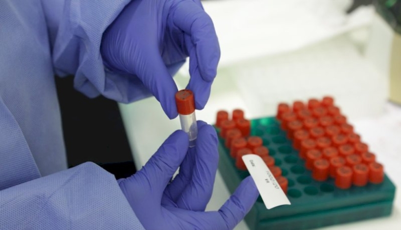 Casos de Covid-19 chegam em 91 municípios de MT