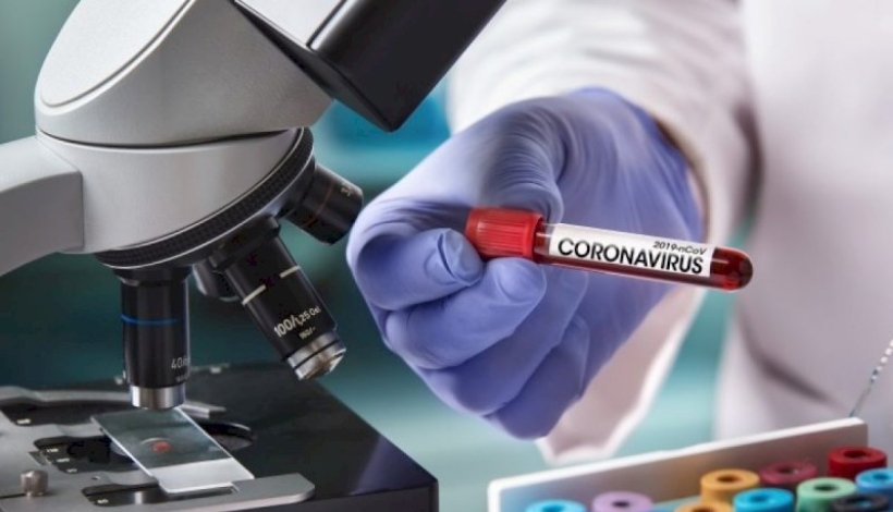 MT tem 15.328 casos confirmados de Covid-19