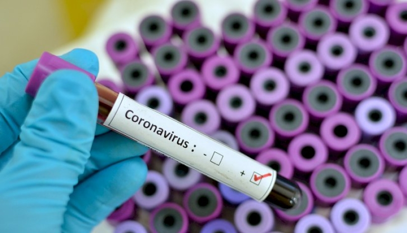 Menino de 9 anos está com Covid-19 em São José de Quatro Marcos