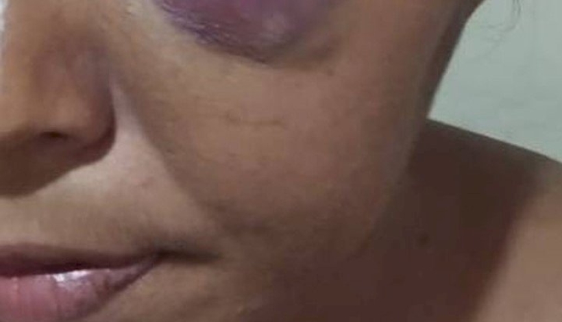 Hóspedes ouvem gritos e marido é preso suspeito de espancar mulher 