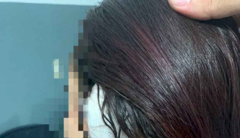 Marido fica com ciúmes e arranca pedaço de orelha da esposa