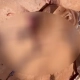 Idosa é atacada por cachorro enquanto entregava leite