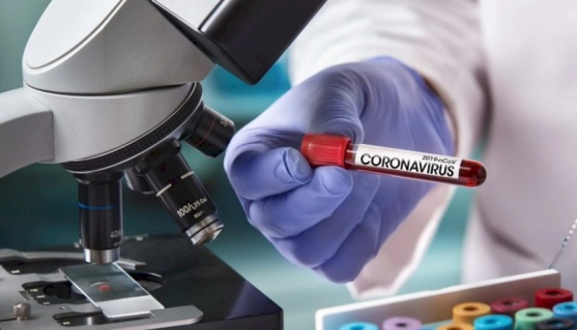 MT tem 15.328 casos confirmados de Covid-19